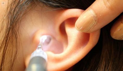 Tapones De Cera Cómo Y Por Qué Se Forman En El Oído Top Doctors
