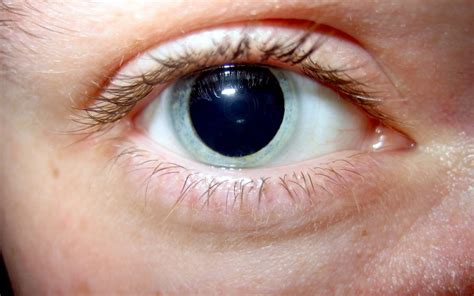 Pupil Dilation A Crucial Part Of Your Comprehensive Eye Exam