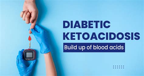 Diabetic Ketoacidosis Symptoms Causes Risk Factors Prevention And More