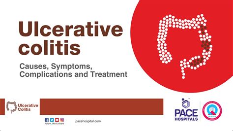 Ulcerative Colitis Causes Symptoms Complications And Treatment