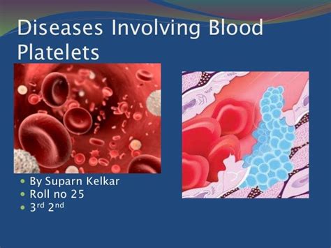 Diseases Involving Blood Platelets
