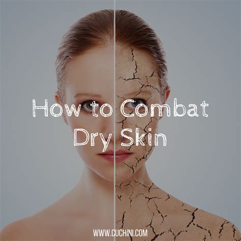 How To Combat Dry Skin Cuchini Blog
