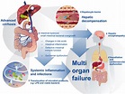 The microbiota in cirrhosis and its role in hepatic decompensation ...