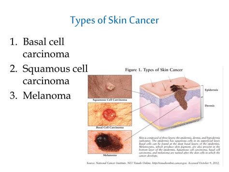 Ppt Skin Cancer Powerpoint Presentation Free Download Id2821931