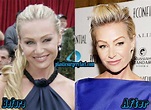 Portia de Rossi Plastic Surgery Before and After Pictures - Plastic ...