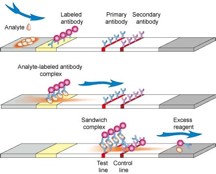 In many cases, the test and control lines show up almost immediately with definitive results available within a few minutes. Common Formats Of Lateral Flow Tests - Creative Diagnostics