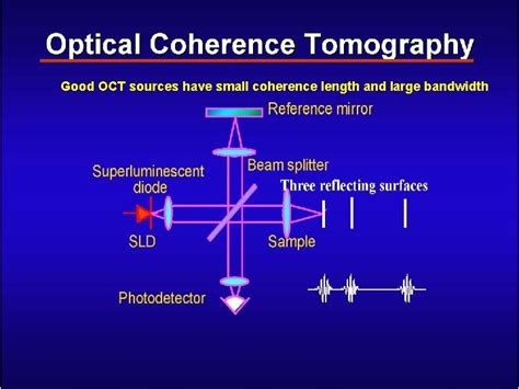 Lecture 23 Optical Coherence Tomography Oct Basic Principles