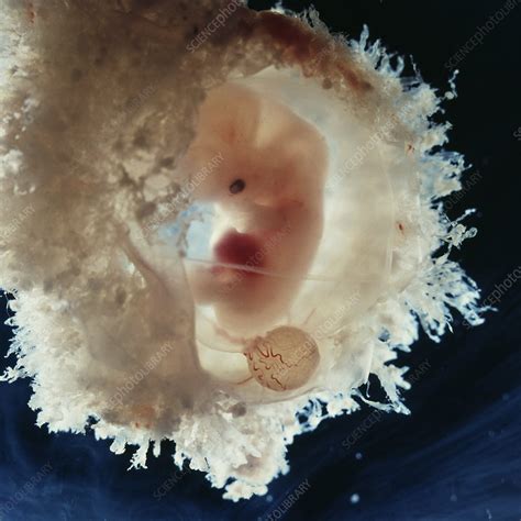 Embryo In Amniotic Sac Five Weeks Stock Image C0487972 Science