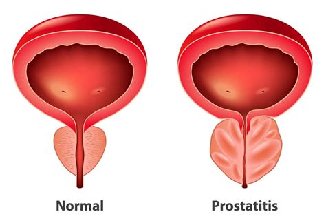 Urologist Singapore Urohealth Medical Clinic