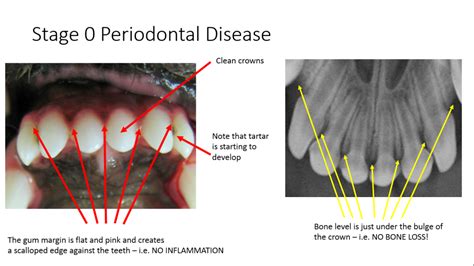 Stages Of Pet Periodontal Disease Anesthesia Free Pet Dental