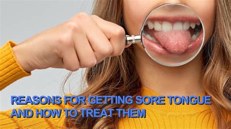 Reasons For Getting Sore Tongue And How To Treat Them Youtube