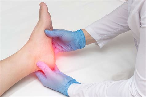 Grapevine Texas Podiatrists For Heel Spurs Alliance Foot And Ankle