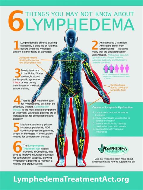 Managing Lymphedema The Story Of This Young Women Uchealth Today