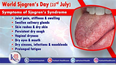 World Sjogrens Day 23rd July 2020
