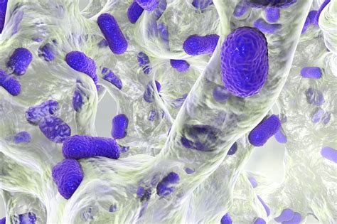 Bacterial Biofilm