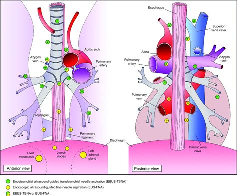 Mediastinal Lymph Node Stations Diagram News Current Station In The Word
