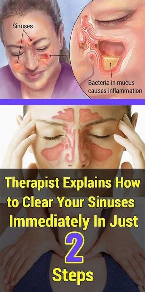 Therapist Explains How To Clear Your Sinuses Immediately In Just Two