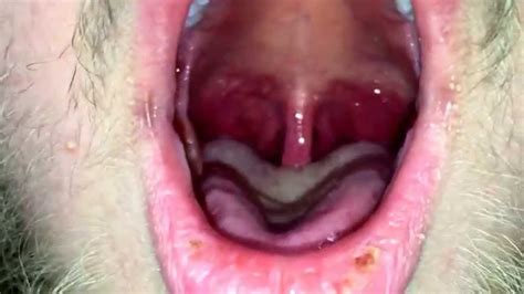Swelling Inside The Throat Hard Orgasm