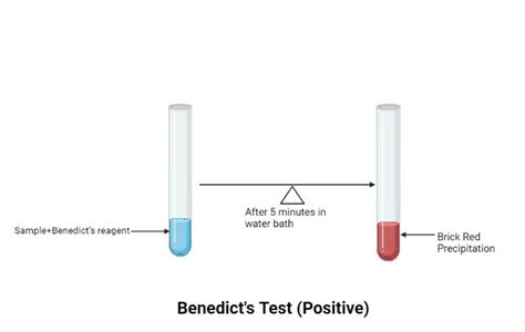 Benedicts Test Principle Procedure Uses And Limitation • Microbe