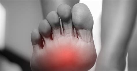 How To Treat Painful Fat Pad Atrophy In The Foot Foot Healthcare