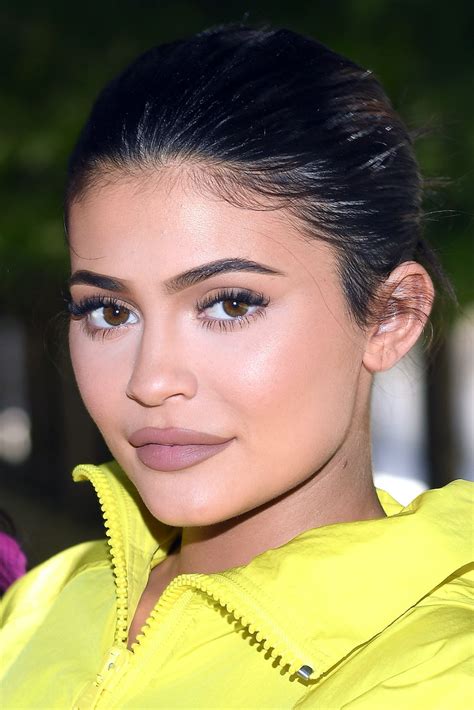 Kylie Jenner Removed Her Lip Fillers