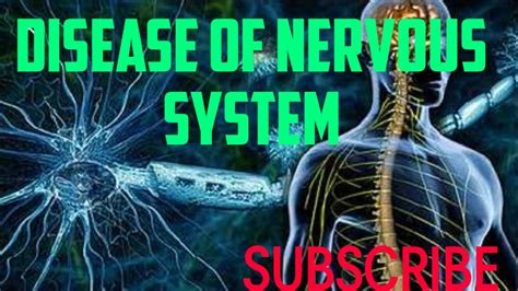 The 18 Most Common Nervous System Diseases Wellnessbeam Riset
