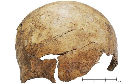 Archaeologists Discover Evidence Of Prehistoric Massacre Broken Bones