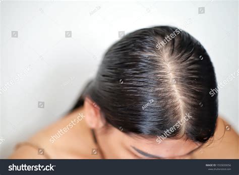 Women Thin Hair There Pulses Hair Stock Photo 1555830056 Shutterstock