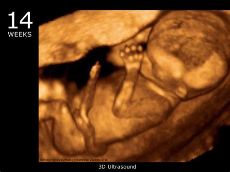 14 Week 3d Ultrasound Baby Picture Pregnancy Symptoms Week By Week