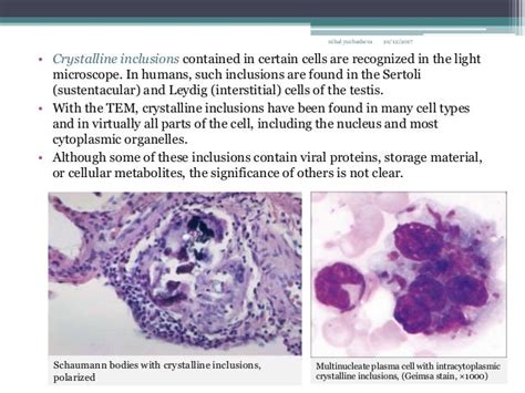 Endosomesperoxisomes Proteasomes Cytoplasmic Inclusions