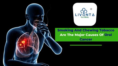 Smoking And Chewing Tobacco Are The Major Causes Of Oral Cancer