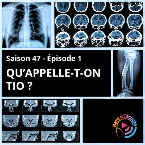 Quappelle T On Tio • Podcast • Rare à Lécoute