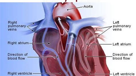 Various Types Of Heart Diseases Causes And Symptoms