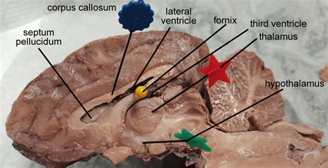 Sheep Brain