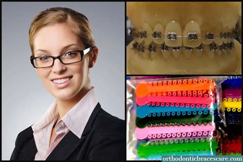 Braces Color Wheel Advantageprint