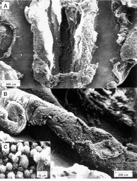 Scanning Electron Micrographs Sem Of Nasal Associated Lymphoid Tissue