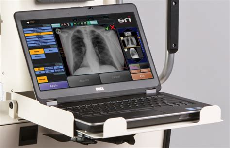 Portable X Ray Systems Make Medical Imaging Easy