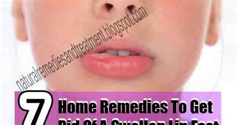 Best Home Remedies To Get Rid Of A Swollen Lip Fast 7 Home Remedies