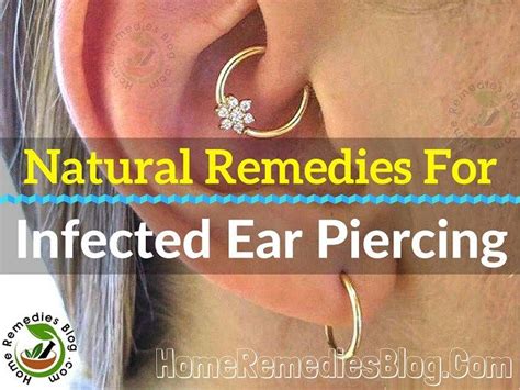 13 Proven Natural Treatments For Infected Ear Piercing Infected Ear Piercing
