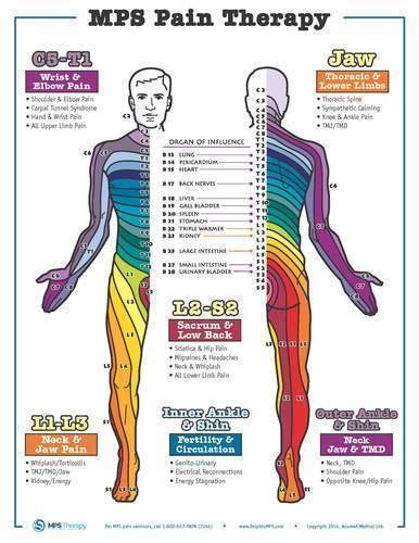 Dermatome Poster Dolphin Neurostim Patient Wprescription