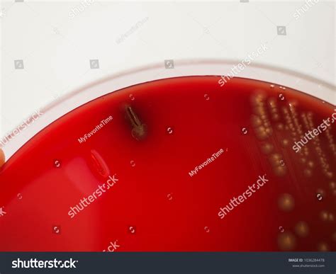 Alphahemolysis Characteristic Streptococcus Pneumoniae On Blood Stock