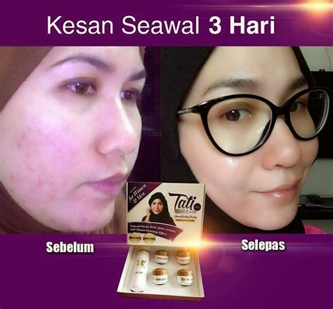 Beauty, cosmetic & personal care. ♥ Rahsia Kecantikan Abadi ♥: ♥ Tati Skincare : Kulit Cerah ...