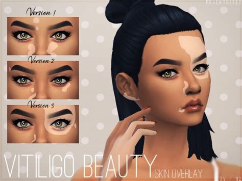The Sims Resource Vitiligo Beauty Skin Overlay N2 By Peachtreees