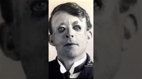 Soldier Faces Before And After World War I Youtube