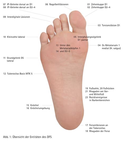 Das Entitätenkonzept In Der Behandlung Des Diabetischen Fußsyndroms