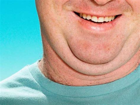 How To Get Rid Of Neck Fat Holistic Meaning