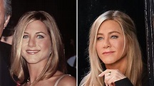 Has Jennifer Aniston Had Plastic Surgery? Comments, Procedures | Life ...