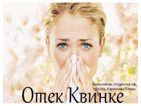 Диета отек квинке крапивница Отек Квинке - презентация онлайн Отек Квинке - презентация онлайн Диета отек квинке крапивница