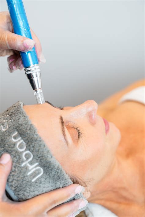 Skin Needling Face Neck And Decolletage Urban Spa