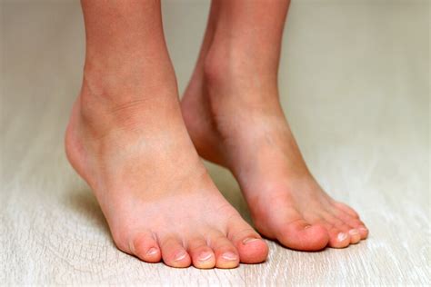Flat Feet In Children What Is It And How Can It Be